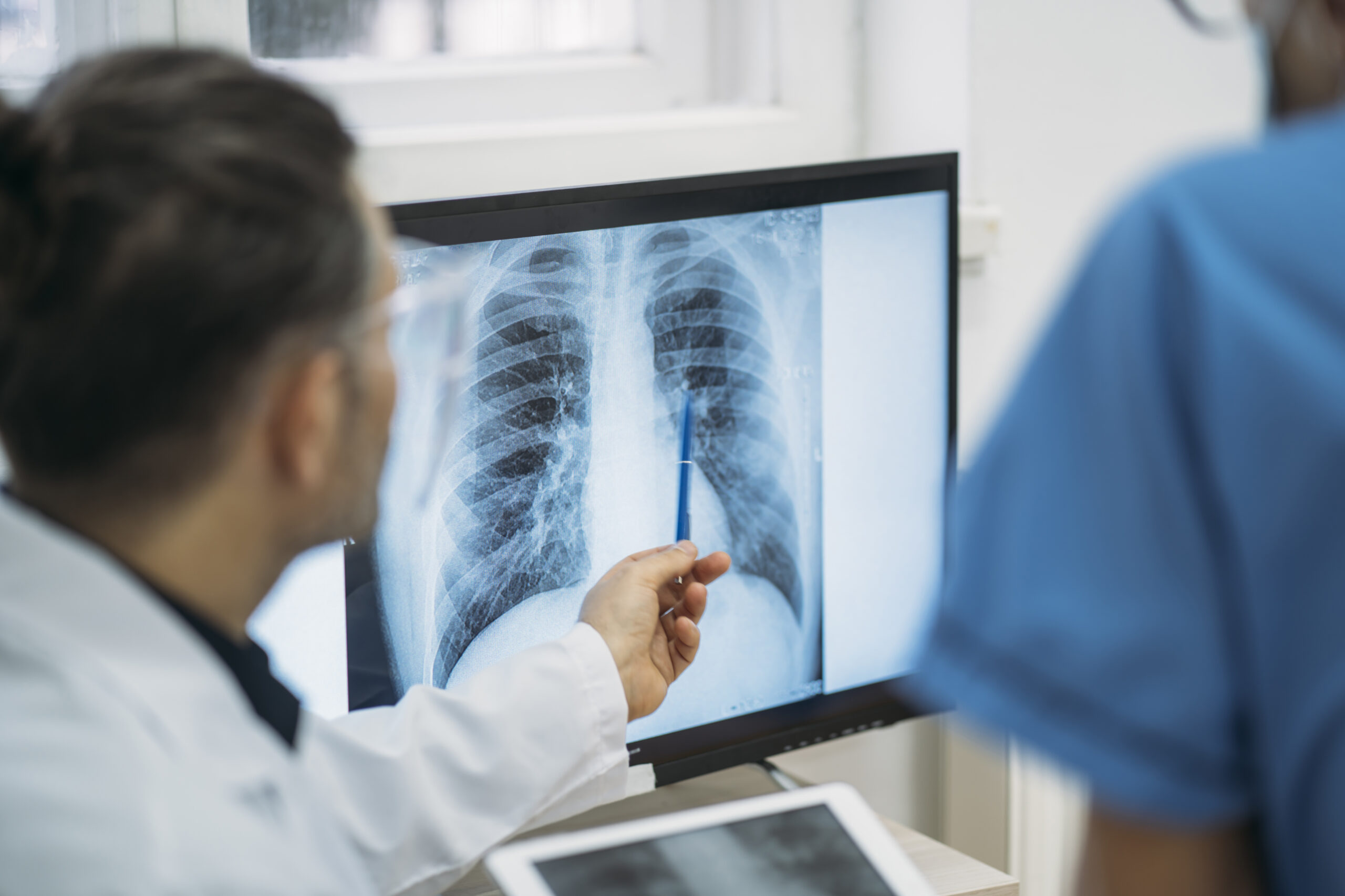 A Faster Way to Diagnose Lung Cancer